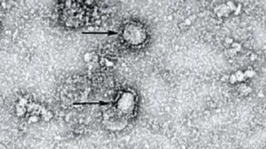 Peneliti : Dalam 18 Bulan Virus Corona Bisa Bunuh 65 Juta Jiwa