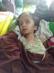 Kisah Nia Fitriani yang Sudah 13 Tahun Menderita Hydrocephalus