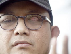 Anies Baswedan Diperiksa KPK Soal Tanah Munjul, Novel :Tak Pernah Berupaya Lindungi Sepupunya