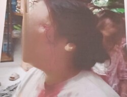 Dituntut 8 Bulan Penjara, Korban Penganiayaan di Pekanbaru Nilai Jaksa Abaikan Rasa Keadilan.